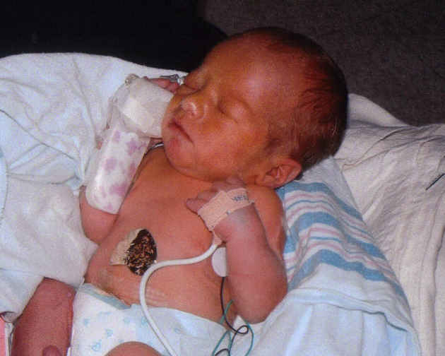 2 days old