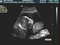 Ed's Profile at 19 weeks gestation